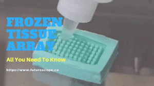 Frozen Tissue Arrays