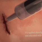 Revolutionary Superglue