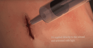 Revolutionary Superglue