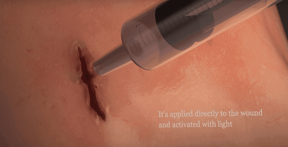 Revolutionary Superglue