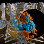 World’s First Full Color 3D X-Rays