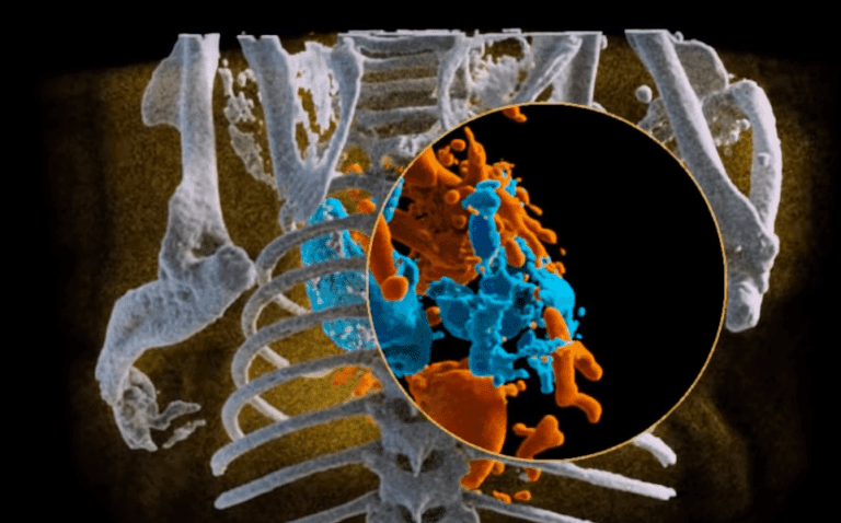 World’s First Full Color 3D X-Rays